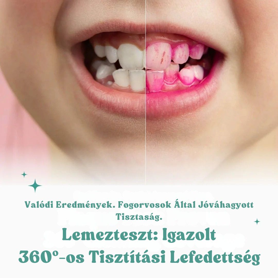 KinderBrush™ Pro - U-Alakú Fogkefe Gyermekeknek